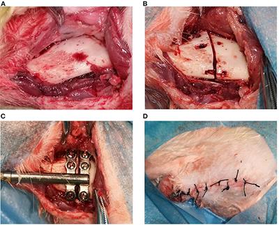 Experimental Study on the Bone Morphogenetic Protein 1-Modified Bone Marrow Mesenchymal Stem Cell Sheets to Promote Mandibular Distraction Osteogenesis